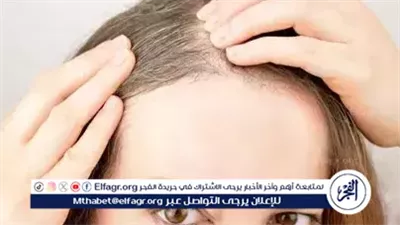 وصفات طبيعية للتخلص من الشيب المبكر في الشعر