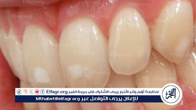العناية بالأسنان.. ابتسامة صحية تدوم مدى الحياة