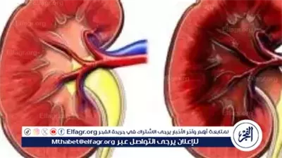 عاجل- باحثون يعلنون اكتشاف طريقة جديدة قد تعكس تلف الكلى بالكامل