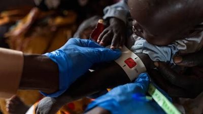 تدهور الأوضاع الصحية في إثيوبيا.. ما السبب؟