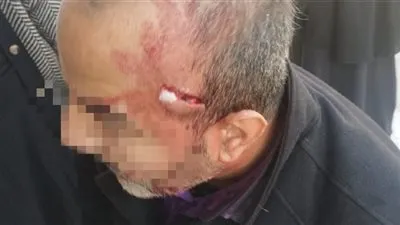 شخص يدعى أنه والد طالبة يعتدى على معلم بآلة حادة فى الإسماعيلية