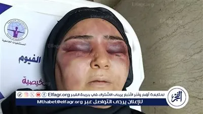 زوج يعتدي بالضرب علي زوجته بالفيوم