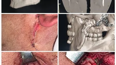 العملية رقم 50… مستشفى شربين المركزي يحقق إنجازًا جديدًا في جراحة الوجه والفكين
