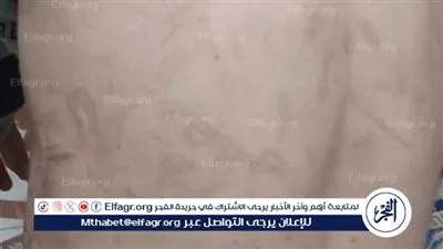 حبس زوجة الأب المتهمة بضرب وتعذيب نجل زوجها بقرية تلات بالفيوم 4 أيام على ذمة التحقيقات 