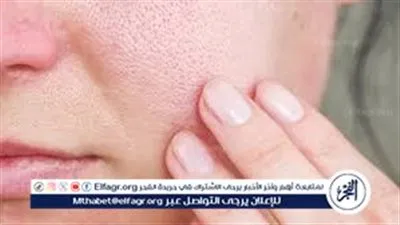 7 خطوات ذكية لتقليل التهابات وجفاف البشرة في الشتاء