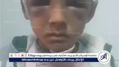 «بيشتري سجائر فرط».. إحالة أب للتحقيق بعد تعديه على نجله الصغير بالمحلة