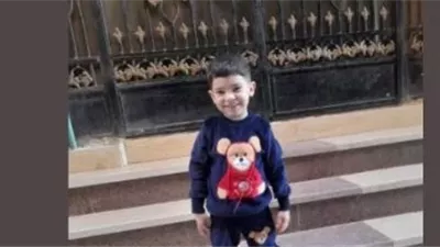 انتهاء جراحة دقيقة لطفل باسوس بمعهد ناصر بعد 19 ساعة.. والأسرة تشكر الأطباء ووزارة الصحة