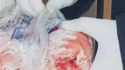 ضبط 6 أطنان دواجن داخل مجزر غير مرخص بالقناطر الخيرية