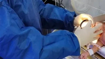 تحرك عاجل من رمد المنصورة لفحص عيون الأطفال المبتسرين بحضانات طلخا المركزي