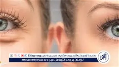 وداعًا لتجاعيد العين.. وصفات طبيعية بسيطة لمظهر أكثر شبابًا