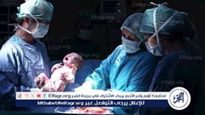 الصحة توضح حالات الولادة القيصرية وتؤكد: القرار طبي لحماية الأم والجنين