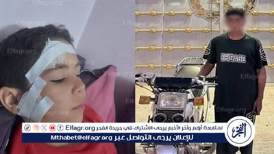 ضبط طالب 13 عاما صدم طفلا بدراجة نارية وفر هاربًا ببني سويف (صور)