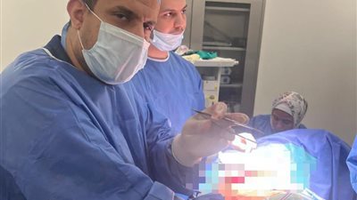 إنجازات طبية دقيقة بمستشفيات جامعة بنها في جراحات القلب والصدر