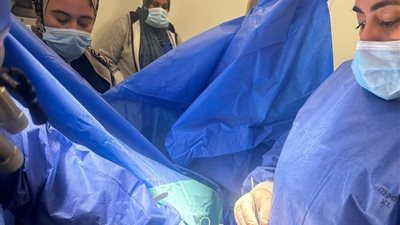 مستشفيات جامعة بنها تنجح في جراحة قلب دقيقة بتقنية حديثة دون شق الصدر التقليدي